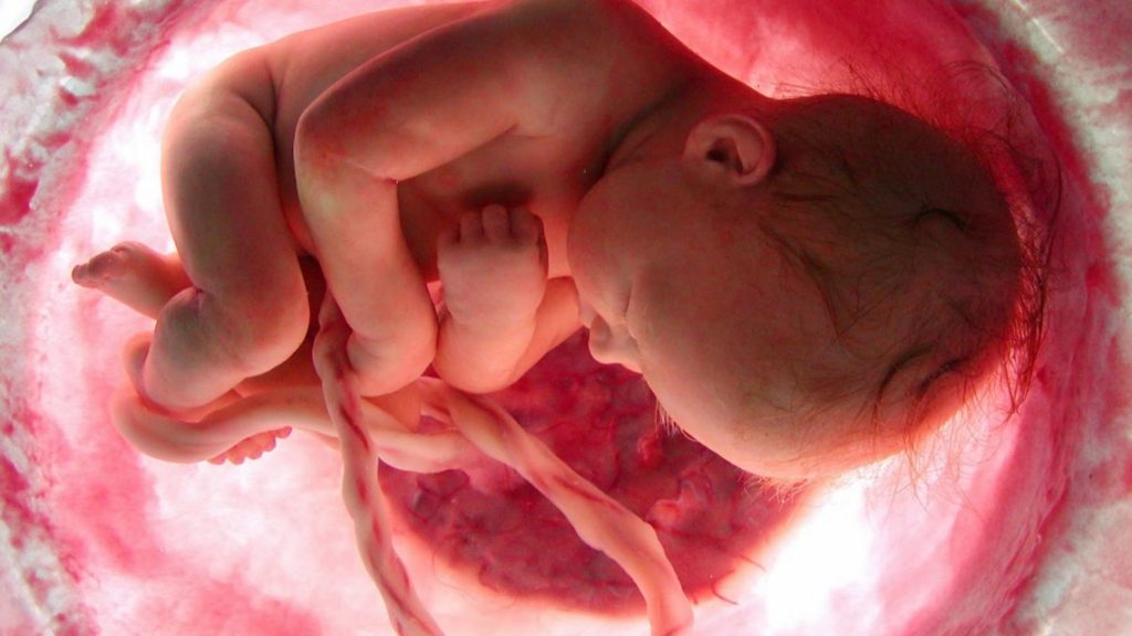 Abortion 3